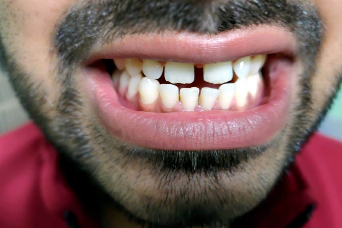 close up of a man with a gap tooth smile