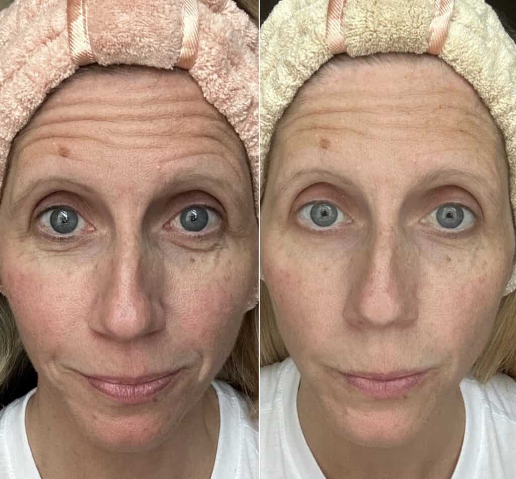 Herbal Face Food Before and After