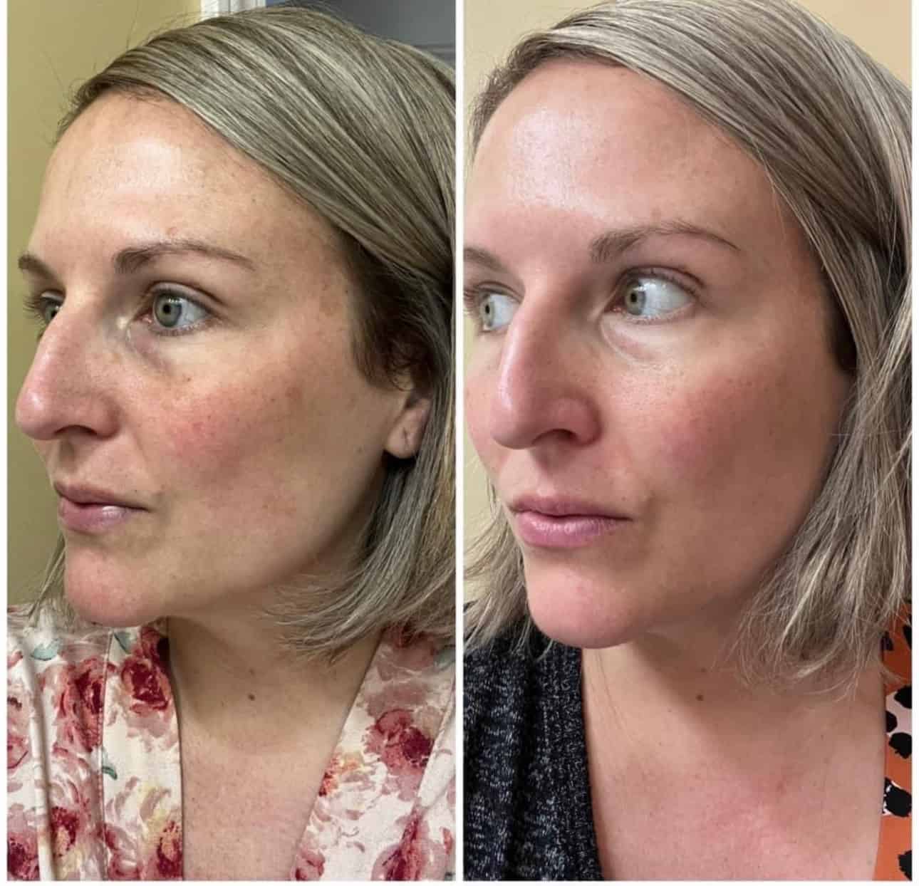 herbal face food affiliate's before and after photo