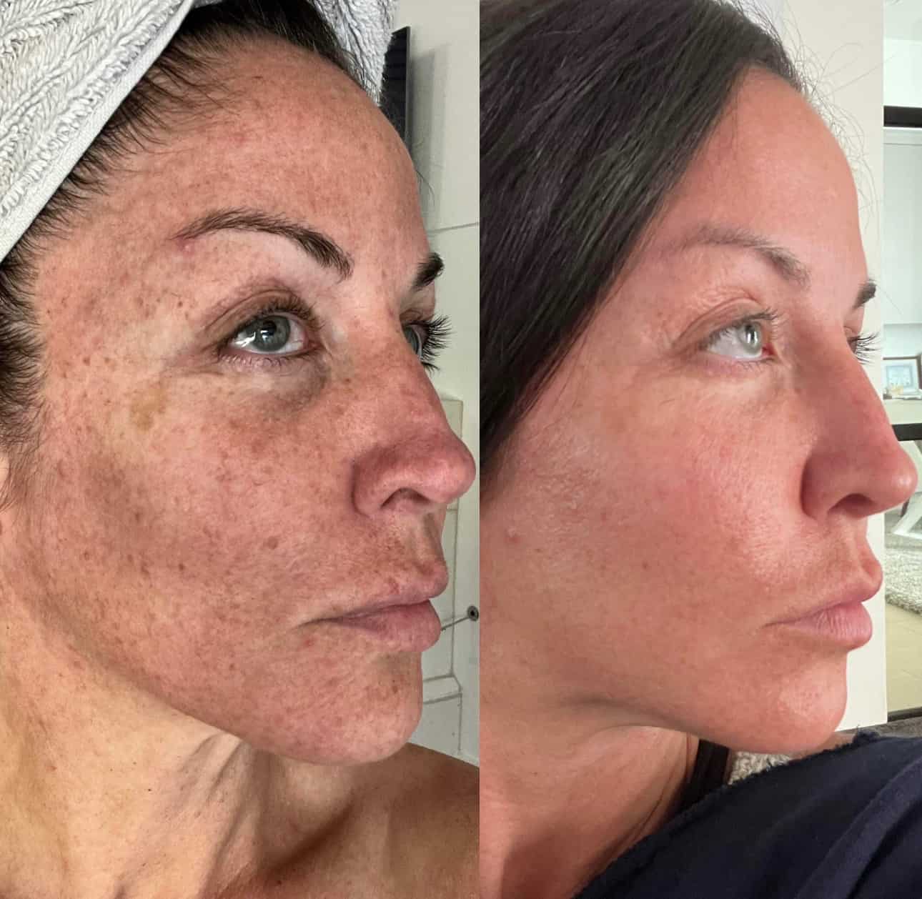 herbal face food affiliate's before and after photo