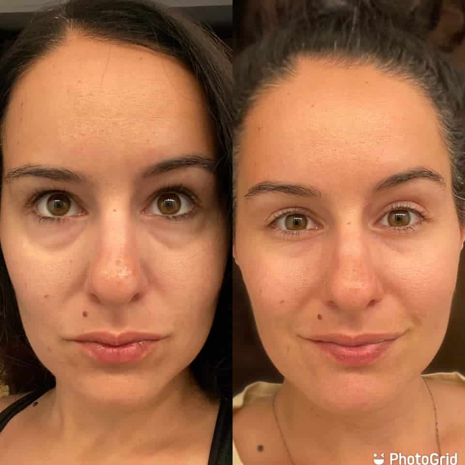 herbal face food before and after face