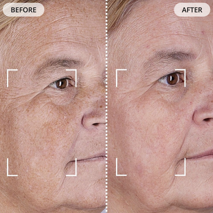 CurrentBody Mask Before and After Evens Skin Tone