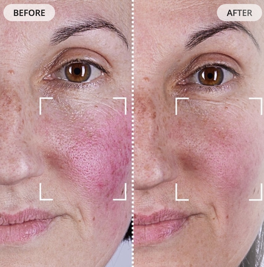 CurrentBody Mask Before and After Less redness