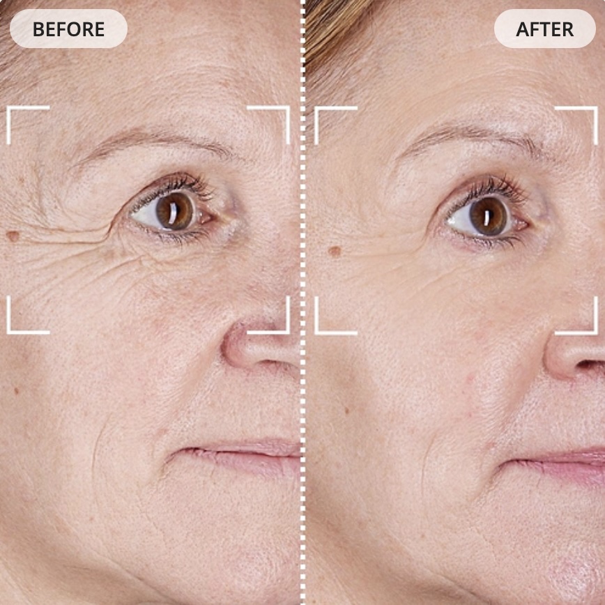 CurrentBody Mask Before and After less wrinkles